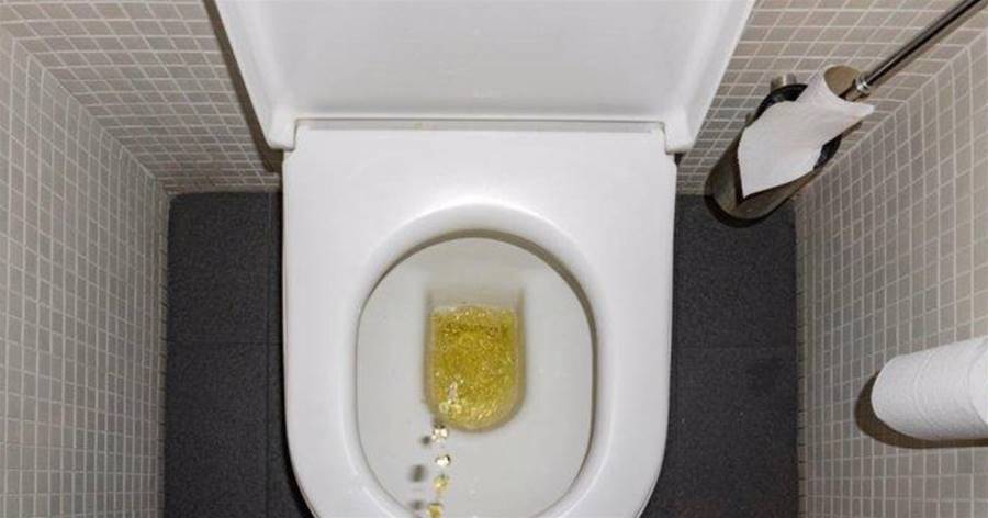 排尿很黃、異味很大?身體在向你暗示這5件事,可能和疾病有關